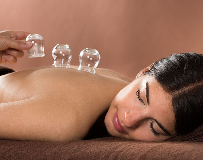Woman getting cupping treatment at spa